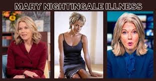 Mary Nightingale Illness: What Do We Know?